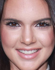Kendall Jenner's lips